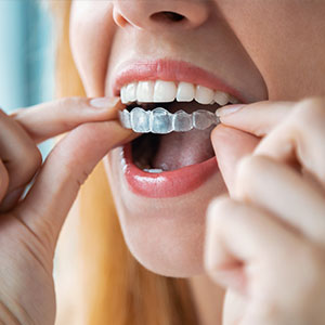 Brian C. Vinson, DMD Family Dentistry | CEREC, E4D and Pediatric Dentistry